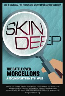دانلود مستند Skin Deep: The Battle Over Morgellons 2019104233-846375698
